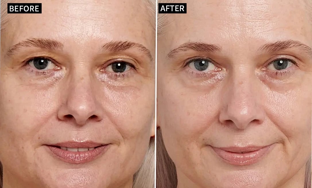 🔥Last Day 69% OFF-Alcuras® Anti-Wrinkle Face Cream🌿