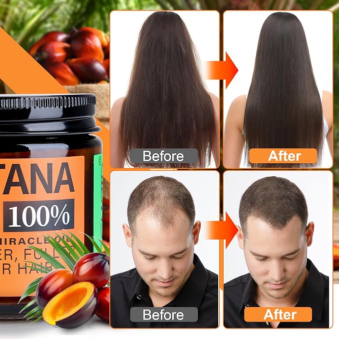 🔥LAST DAY 50% OFF - Batana Oil for Hair Growth,Raw Organic Batana Mask from Honduras🌱