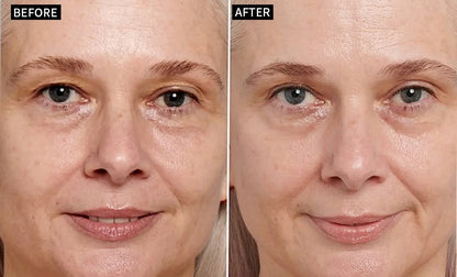 🔥Last Day 69% OFF-Alcuras® Anti-Wrinkle Face Cream🌿