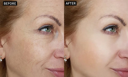 🔥Last Day 69% OFF-Alcuras® Anti-Wrinkle Face Cream🌿